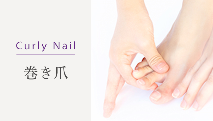 Curly Nail 巻き爪